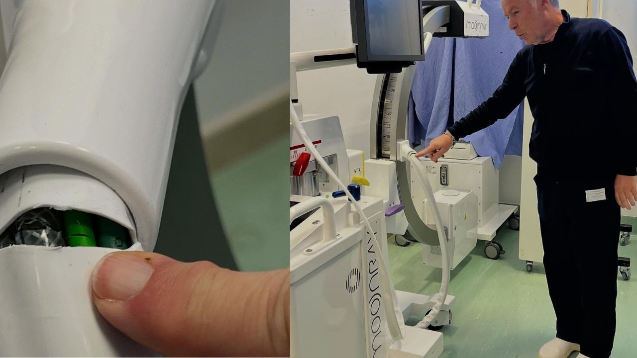 Danni all'ospedale di Manfredonia