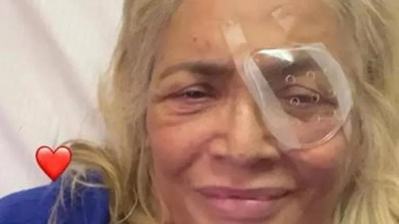 Mara Venier occhio ospedale