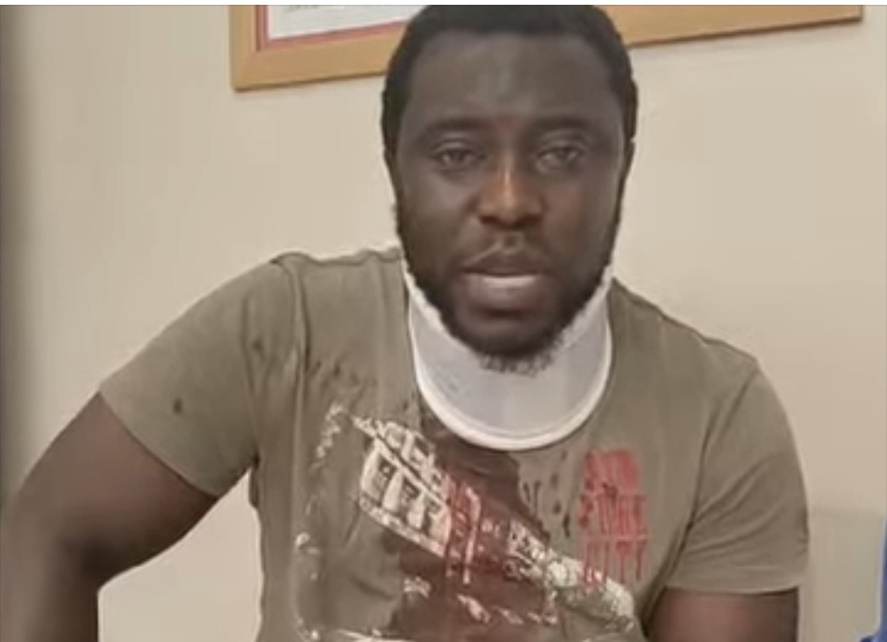 ghanese picchiato a manfredonia dopo un incidente da Ilsipontino.net ghanese picchiato a manfredonia dopo un incidente