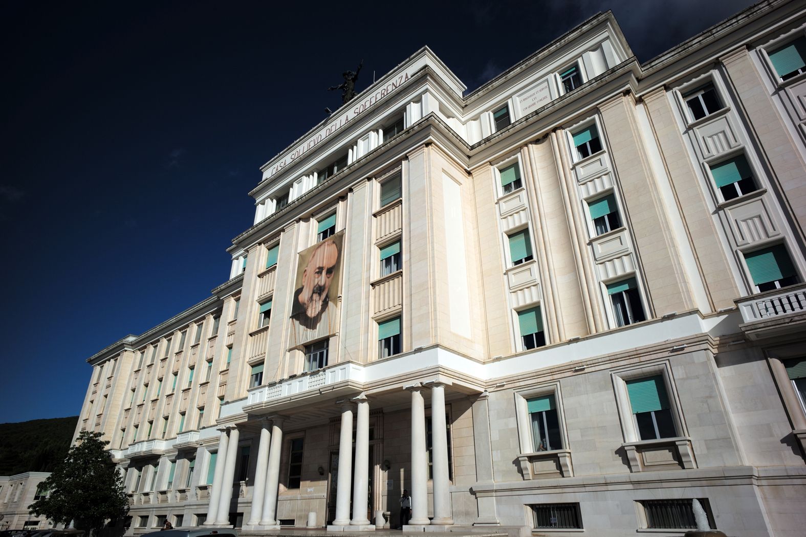 ipertensione resistente ottimi risultati dalla prima denervazione renale eseguita all8217irccs casa sollievo della sofferenza da Ilsipontino.net ipertensione resistente ottimi risultati dalla prima denervazione renale eseguita all8217irccs casa sollievo della sofferenza